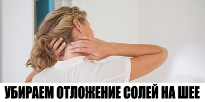 Как лечить остеохондроз, удаляем соли в шейном отделе